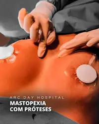 videos de cirurgias plasticas